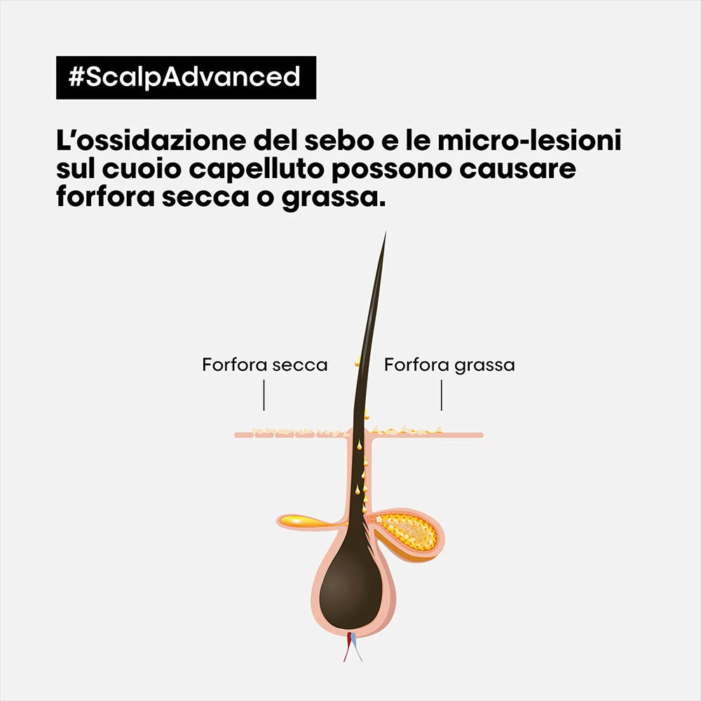 L'Oreal Professionnel Paris Scalp Advanced Anti-Dandruff Shampoo 300ml - Shampooing Antipelliculaire – Image 2